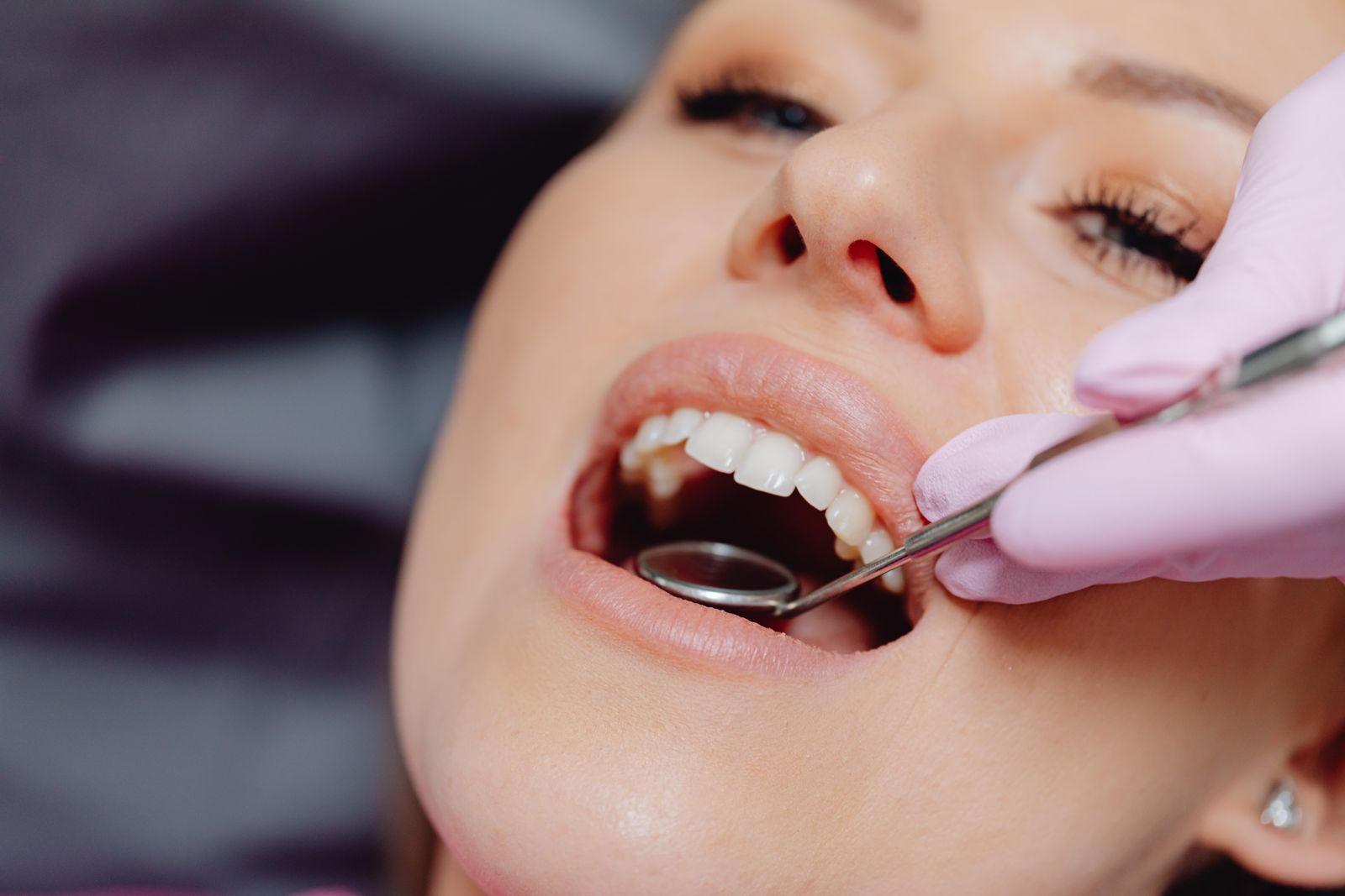 Bilan Parodontal — Wilson Dental