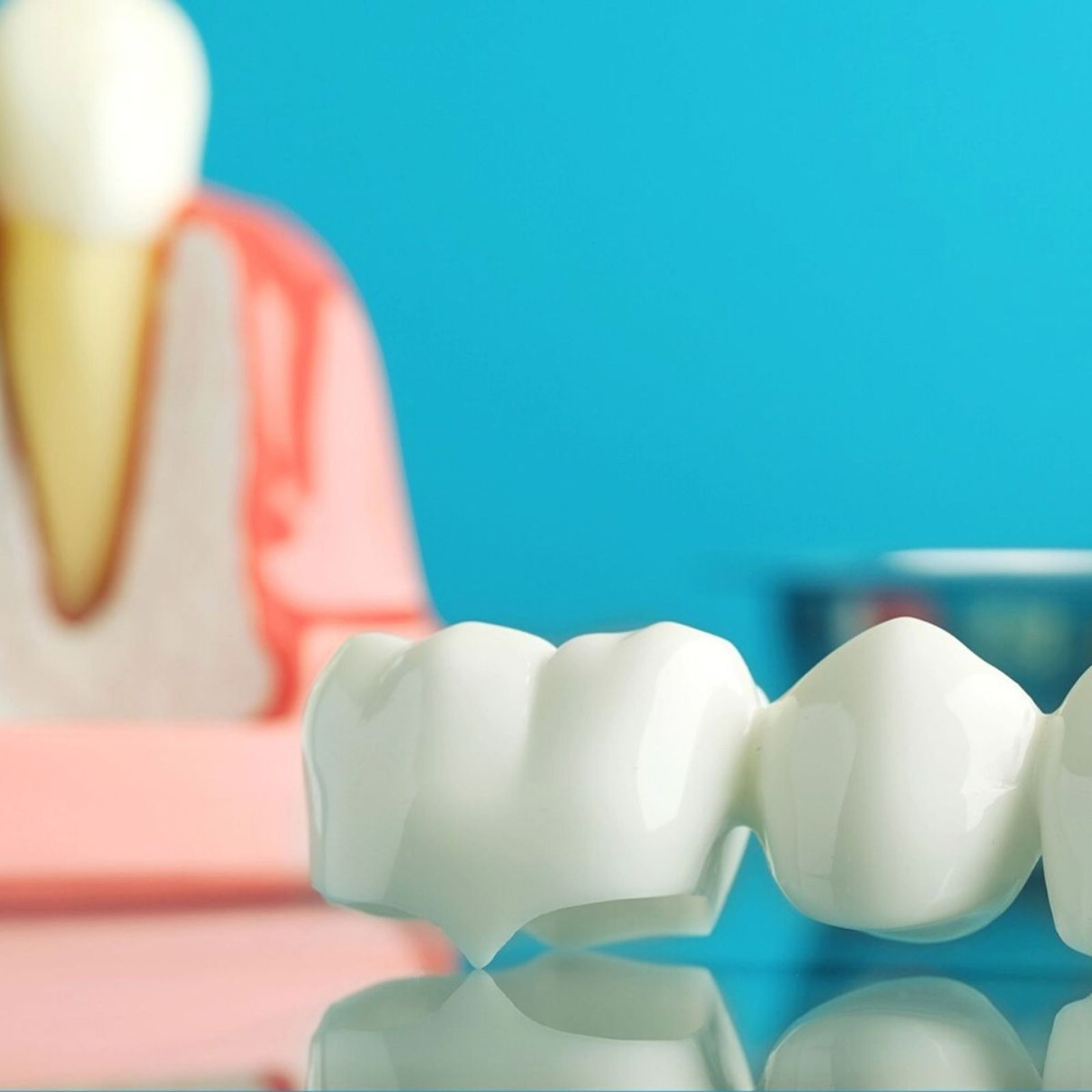 Couronnes Dentaires — Wilson Dental
