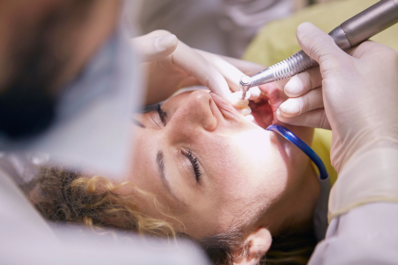 Détartrage Professionnel — Wilson Dental