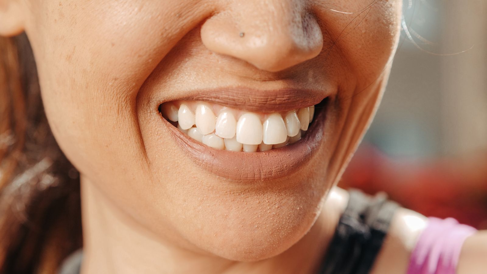 Greffes Gingivales — Wilson Dental