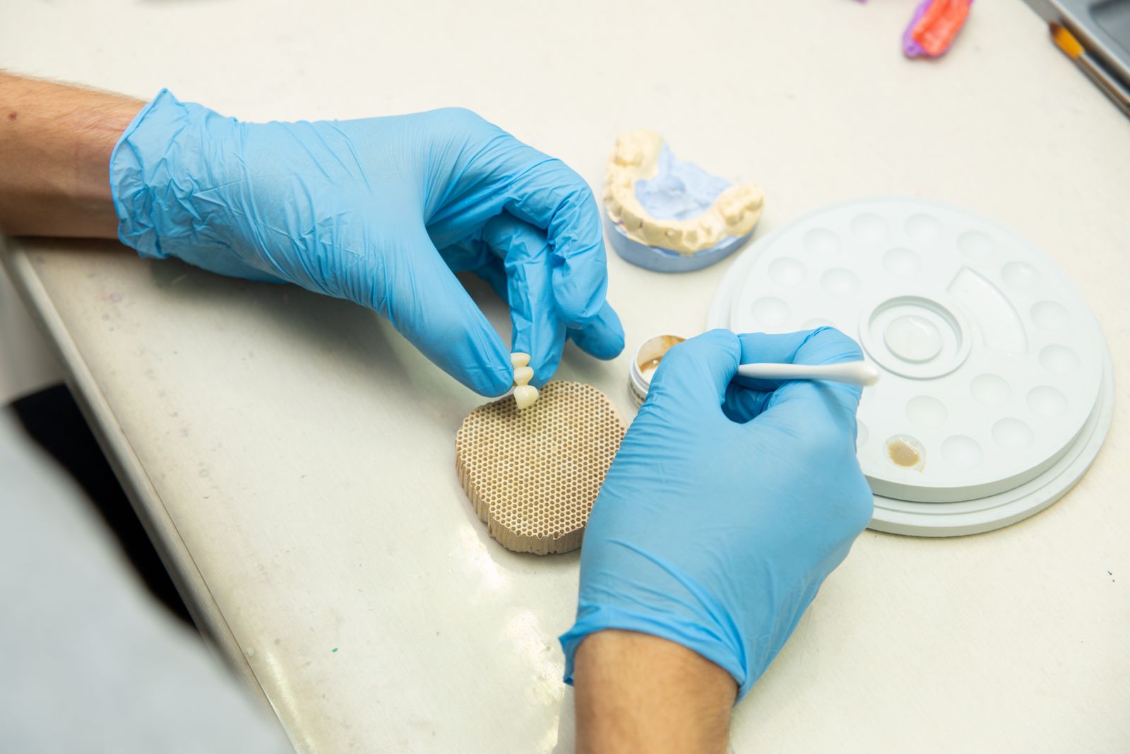 Inlays & Onlays — Wilson Dental